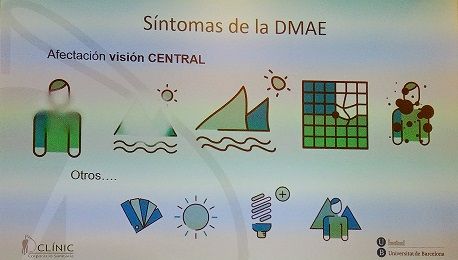 Cuidado de la visión