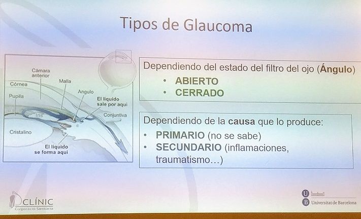 Cuidado de la visión